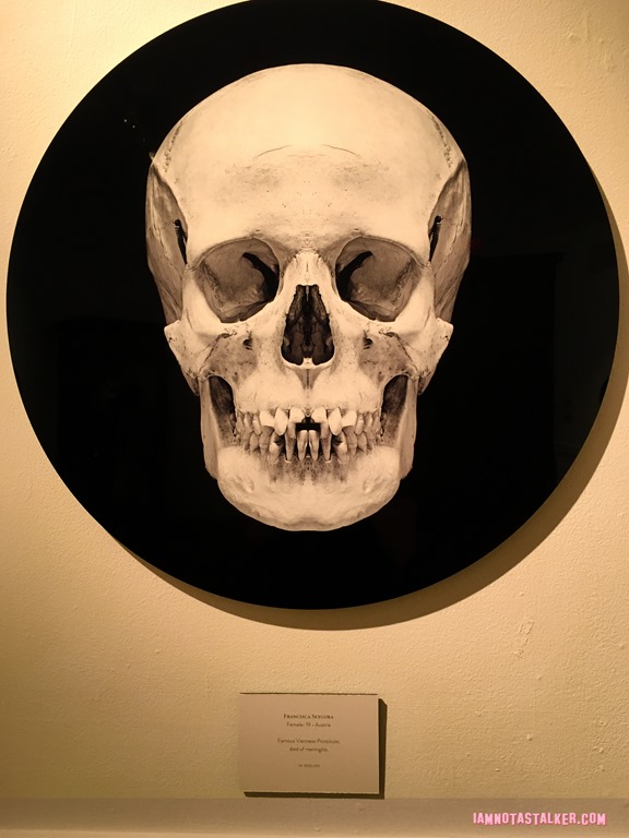 The Mutter Museum-5755