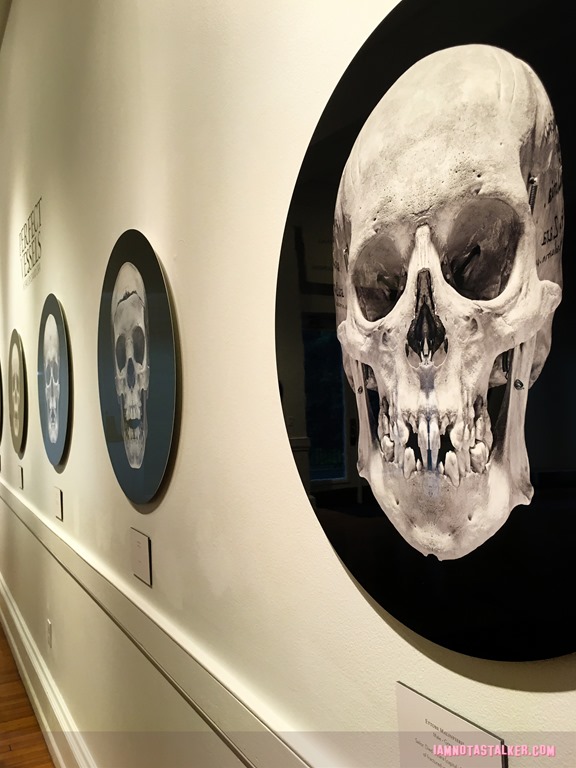 The Mutter Museum-5757